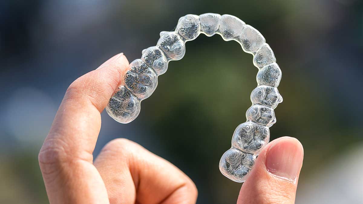 The fitting technique to Recycle Invisalign Trays